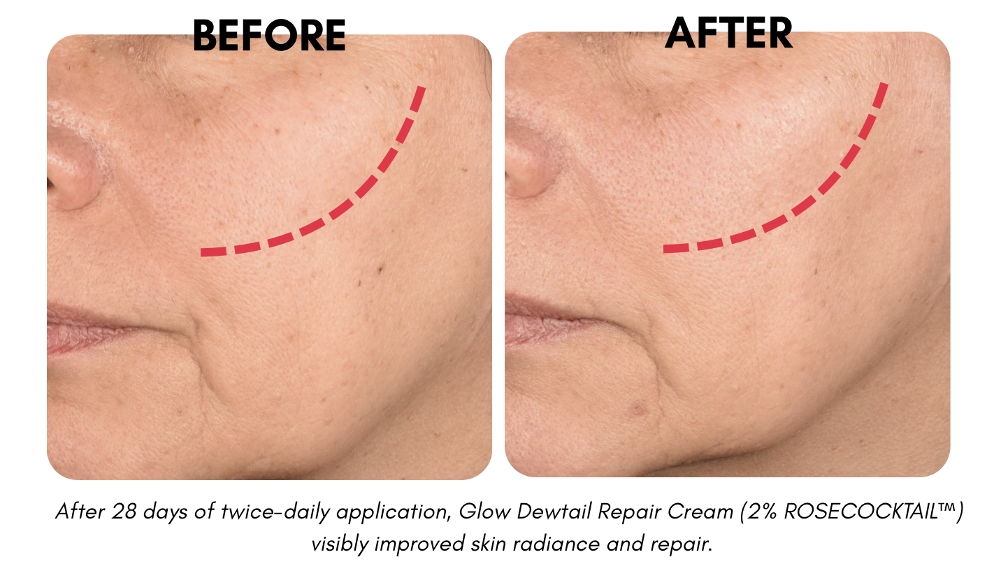 Skin before/after treatment